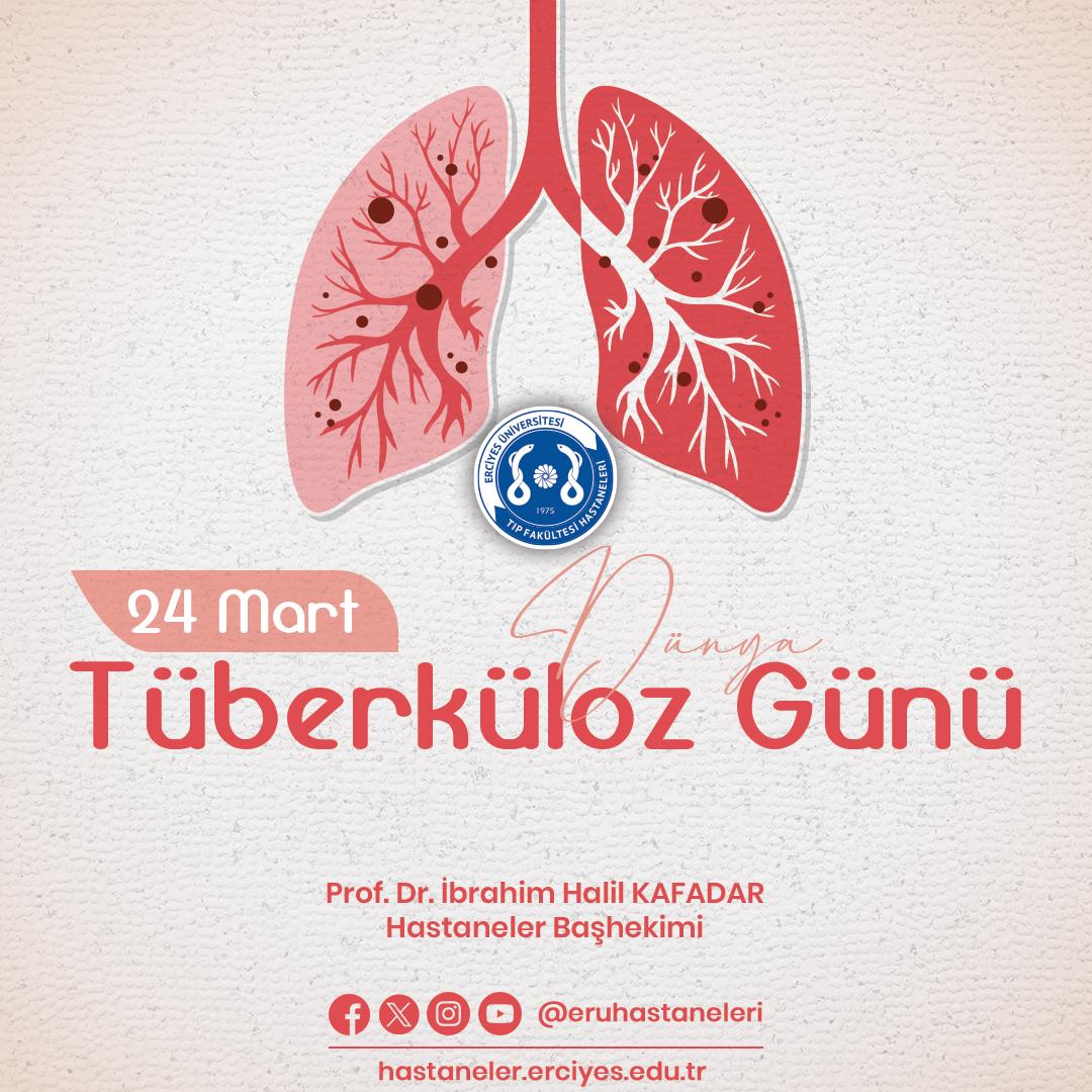 24 Mart Dünya Tüberküloz Günü